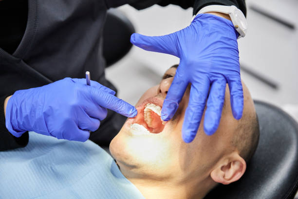 Best Emergency Dentist for Lost Fillings or Crowns in West Dundee, IL